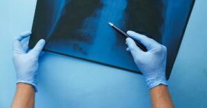 Read more about the article C8 Medical Panel Releases Screening Guidelines