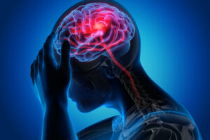 Read more about the article $1.375 Million Awarded In Brain Injury Lawsuit To 4 Electricians Injured On The Job