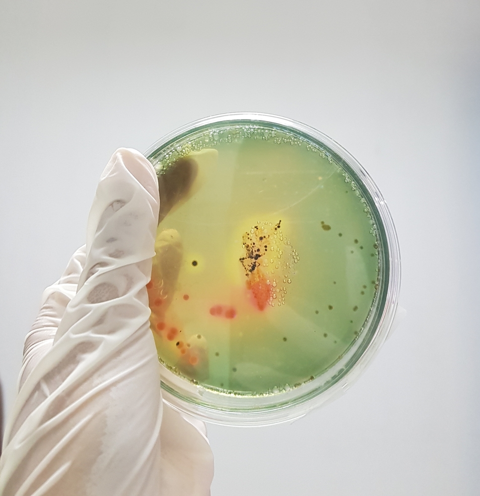 You are currently viewing Mt. Healthy Hatcheries In Ohio Linked To Salmonella Outbreak